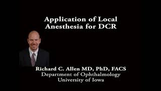 Application of local anesthesia for a dacryocystorhinostomy DCR [upl. by Krystalle230]