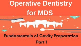 Operative Dentistry  Fundamentals of Cavity Preparation Part 1 [upl. by Ecinreb855]