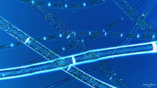 Zygnematales Conjugates Spirogyra Zygnema Mougeotia [upl. by Idaline]