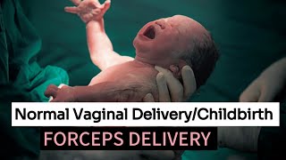 Normal vaginal DeliveryChildbirth deliveryLabor pain stagesCervix Dilation during pregnancy🧘 [upl. by Cami]