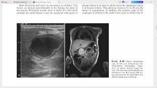 PAEDIATRIC IMAGING [upl. by Sheff]