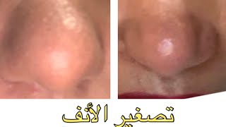 plasmapen fibroblast plaxel تصغير الأنف بدون عملية جراحية [upl. by Nomae]