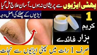 Remove Cracked Heels at home tips amp tricks Get Beautiful Feet Permanently Homemade Cream Remedies [upl. by Ano]