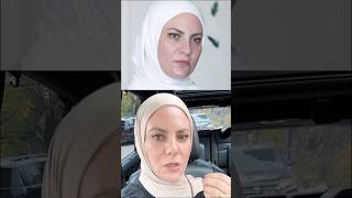 Face Lift amp Rhinoplasty in Turkey  Wajeeha  Kuwait [upl. by Sieracki]