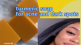 HOW TO MAKE TUMERIC SOAP FOR ACNE AND DARK SPOT [upl. by Consolata]