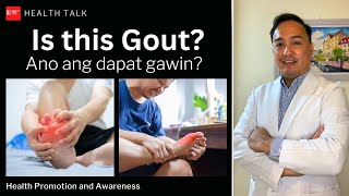 Gout nga ba ito Ano ang dapat gawin [upl. by Lamaaj12]