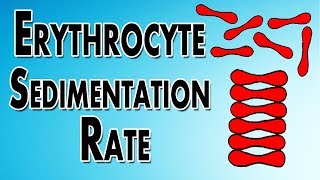 Erythrocyte Sedimentation Rate [upl. by Niuqauj]