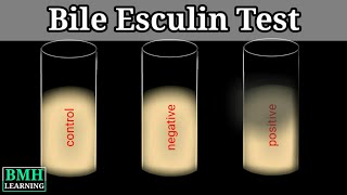 Bile Esculin Test  Bile Esculin Test For Enterococcus Identification  Bile Esculin Agar [upl. by Ardeth]