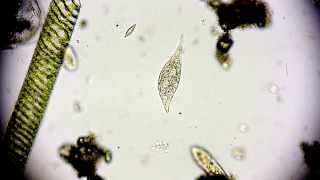 Amphileptus meleagris  Ciliate  Wimpertierchen  Hemiophrys meleagris  microorganisms microscope [upl. by Atirma]