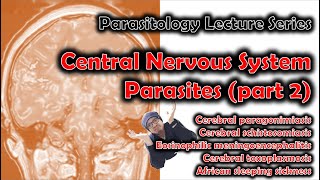 CNS Parasites part 2 parasites brain [upl. by Sclater]