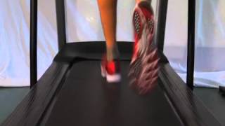 Flatfeet advice for runners [upl. by Eden]