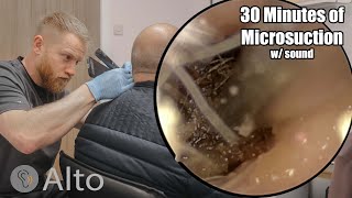 30 Minutes of MICROSUCTION Ear Wax Removal [upl. by Snah803]