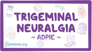 Trigeminal neuralgia Nursing Process ADPIE [upl. by Hamachi]