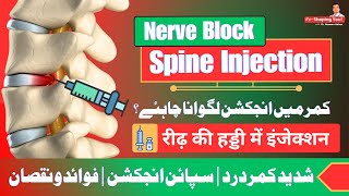 Nerve Block Injection  Good or Bad  UrduHindi [upl. by Alhsa]