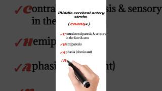 middle cerebral artery stroke [upl. by Laen]