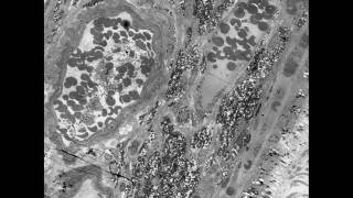 What is the mode of action of antivascular endothelial growth factor drugs in wet AMD [upl. by Eckel]