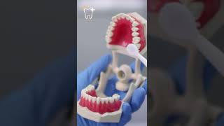 Removable Partial Dentures [upl. by Quiteria125]