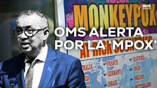 OMS DECLARA ALERTA a nivel MUNDIAL por VIRUELA del mono [upl. by Pyle]