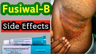 FusiwalB cream  best antibacterial cream पूरी जानकारी हिंदी में fusiwal [upl. by Ffilc]