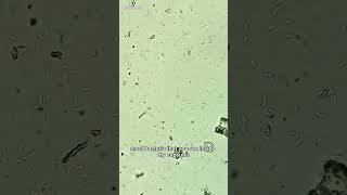 Good Bacteria Under Microscope Lactobacillus acidophilus [upl. by Eusassilem869]