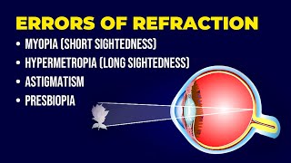 Errors of Refraction  Myopia  Hypermetropia  Astigmatism  Presbiopia  Short amp Long Sightedness [upl. by Ubana]