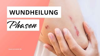 Wundheilungsphasen So läuft die Wundheilung ab [upl. by Nabois474]