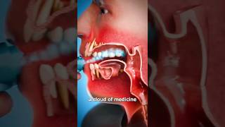 How An Inhaler Works 🤔viral shorts ‎drMaryamGull [upl. by Anerak574]