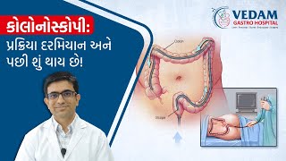 Colonoscopy  What Really Happens During and After the Procedure [upl. by Nehemiah]