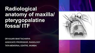 Radiological anatomy of maxillapterygopalatine fossa infratemporal fossa  Dr Kajari Bhattacharya [upl. by Elraet]