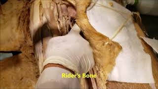 Medial Thigh Muscles – Hip Adductors HD Video – Sanjoy Sanyal [upl. by Brookes]