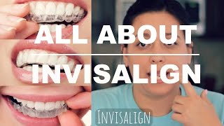 INVISALIGN REVIEW  HOW IT WORKS AND WHAT TO EXPECT [upl. by Crean]