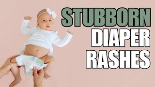 Pediatrician Explains Diaper Rash Advice Best Creams amp Prevention [upl. by Uuge]