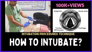 HOW TO INTUBATE INTUBATION PROCEDURE amp TECHNIQUE [upl. by Farrish]