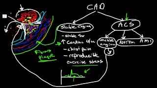 Pathophysiology of Coronary Artery Disease [upl. by Claudine]