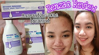 Benzac  Benzoyl Peroxide Review Benzac AC Wash 5 and Spots Treatment 10 [upl. by Mellman]