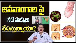 Herpes Simplex Virus  Types Symptoms And Causes  Treatment And Prevention  Telugu  Dr Anjali [upl. by Komara937]