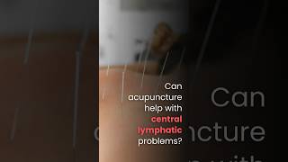 Can acupuncture help with central lymphatic problems [upl. by Syhr230]