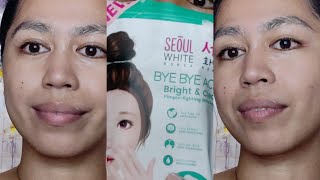 Seoul White Korea Bye Bye Acne ❤️❤️❤️ Bright amp Clear review  tagalog  pompomlab [upl. by Samantha181]