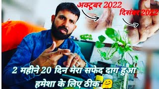 Video Vitiligo Vlogger आज मेरा सफेद दाग हुआ हमेशा के लिए ठीक [upl. by Allisan910]