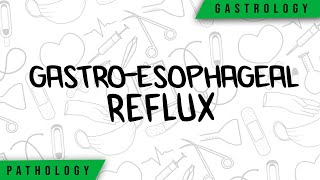 GastroEsophageal Reflux  Physiopathology Symptoms Complications Treatment [upl. by Artur]