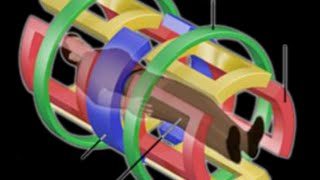 An Application of Inorganic Chemistry in Healthcare  Magnetic Resonance Imaging MRI [upl. by Adnaluoy]