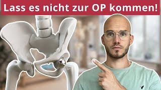 Verkürzter Hüftbeuger Dehnen hilft nicht [upl. by Quinn]