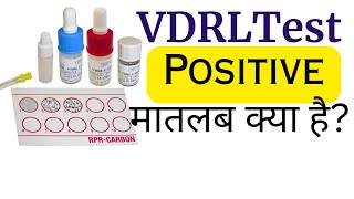 VDRL Test Hindi  VDRL test kya hota hai [upl. by Chemosh9]