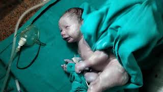 Newborn baby Care  Imnediately after birth  Newborn baby just after delivery  newbornbaby birth [upl. by Cruz463]