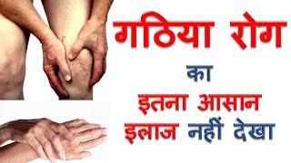 गठिया जोड़ों के दर्द का घरेलू उपाय Gathiya Ka ilaj Home Remedies For Arthritis Joint Pain In Hindi [upl. by Fleece]