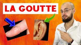 Comment la GOUTTE attaque la PEAU et les REINS [upl. by Ainocal]