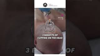 3 BENEFITS of Cupping on the head [upl. by Neerol]