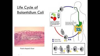 Balantidium Coli Class Ciliate Parasitology [upl. by Haggi]