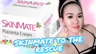 SKINMATE PLACENTA CREAM  FULL HONEST REVIEW [upl. by Nade]