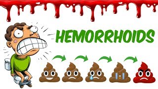 The Hemorrhoids [upl. by Bristow]